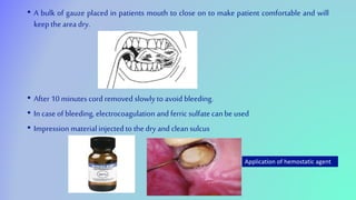 • A bulk of gauze placed in patients mouth to close on to make patient comfortable and will
keep the area dry.
• After 10 minutes cord removed slowlyto avoid bleeding.
• In case of bleeding, electrocoagulation and ferric sulfate canbe used
• Impression material injected to the dry and cleansulcus
Application of hemostatic agent
 