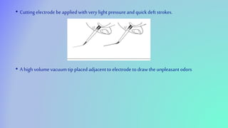 • Cutting electrode be applied with very light pressure andquick deft strokes.
• A high volume vacuum tip placed adjacentto electrode to draw the unpleasantodors
 