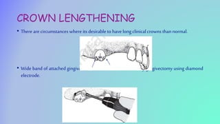 CROWN LENGTHENING
• There are circumstances where its desirable to have long clinicalcrowns thannormal.
• Wide band of attached gingiva around the tooth is removed by gingivectomy using diamond
electrode.
 