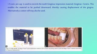 • A com- pre cap is used to encircle the tooth Gingitrac impression material, Gingitrac- Centrix. This
enables the material to be pushed downward, thereby causing displacement of the gingiva.
Alternatively a cotton roll may alsobe used.
 