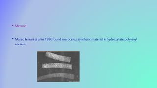 • Merocel
• Marco Ferrari et al in 1996 found merocele,a synthetic material ie hydroxylate polyvinyl
acetate.
 