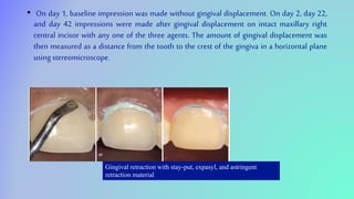 • On day 1, baseline impression was made without gingival displacement. On day 2, day 22,
and day 42 impressions were made after gingival displacement on intact maxillary right
central incisor with any one of the three agents. The amount of gingival displacement was
then measured as a distance from the tooth to the crest of the gingiva in a horizontal plane
using stereomicroscope.
Gingival retraction with stay-put, expasyl, and astringent
retraction material
 