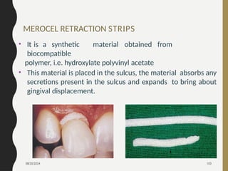 08/20/2024 103
MEROCEL RETRACTION STRIPS
• It is a synthetic material obtained from
biocompatible
polymer, i.e. hydroxylate polyvinyl acetate
• This material is placed in the sulcus, the material absorbs any
secretions present in the sulcus and expands to bring about
gingival displacement.
 