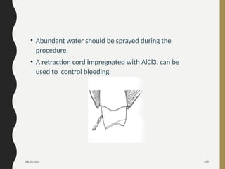 08/20/2024 109
• Abundant water should be sprayed during the
procedure.
• A retraction cord impregnated with AlCl3, can be
used to control bleeding.
 