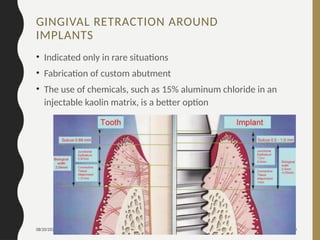 08/20/2024 130
GINGIVAL RETRACTION AROUND
IMPLANTS
• Indicated only in rare situations
• Fabrication of custom abutment
• The use of chemicals, such as 15% aluminum chloride in an
injectable kaolin matrix, is a better option
 