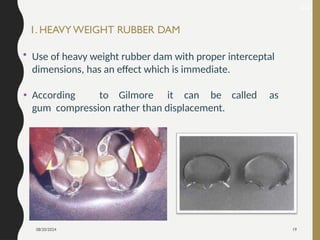 08/20/2024 19
• Use of heavy weight rubber dam with proper interceptal
dimensions, has an effect which is immediate.
• According to Gilmore it can be called as
gum compression rather than displacement.
1. HEAVY WEIGHT RUBBER DAM
22
 