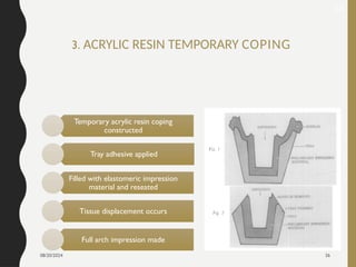 08/20/2024 26
3. ACRYLIC RESIN TEMPORARY COPING
33
Temporary acrylic resin coping
constructed
Tray adhesive applied
Filled with elastomeric impression
material and reseated
Tissue displacement occurs
Full arch impression made
 