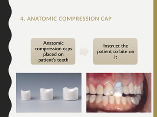 08/20/2024 27
4. ANATOMIC COMPRESSION CAP
Anatomic
compression caps
placed on
patient’s teeth
Instruct the
patient to bite on
it
 