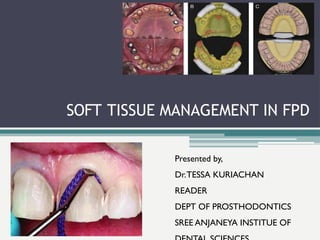 SOFT TISSUE MANAGEMENT IN FPD
Presented by,
Dr.TESSA KURIACHAN
READER
DEPT OF PROSTHODONTICS
SREE ANJANEYA INSTITUE OF
 