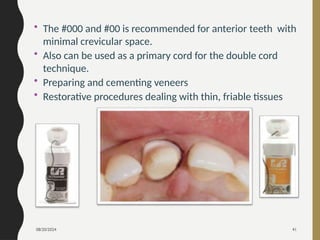 08/20/2024 41
• The #000 and #00 is recommended for anterior teeth with
minimal crevicular space.
• Also can be used as a primary cord for the double cord
technique.
• Preparing and cementing veneers
• Restorative procedures dealing with thin, friable tissues
 