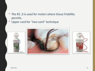 08/20/2024 43
• The #2 ,3 is used for molars where tissue friability
permits.
• Upper cord for "two-cord" technique
 
