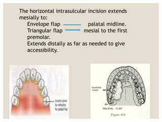 Soft tissue managment | PPTX