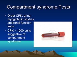 Compartment syndrome:TestsCompartment syndrome:Tests
• Order CPK, urine,
myoglobulin studies
and renal function
tests
• CPK > 1000 units
suggestive of
compartment
syndrome
 