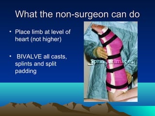 What the non-surgeon can doWhat the non-surgeon can do
• Place limb at level of
heart (not higher)
• BIVALVE all casts,
splints and split
padding
 