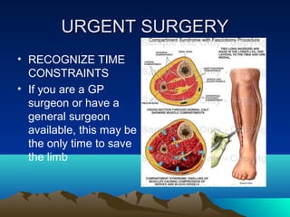 URGENT SURGERYURGENT SURGERY
• RECOGNIZE TIME
CONSTRAINTS
• If you are a GP
surgeon or have a
general surgeon
available, this may be
the only time to save
the limb
 