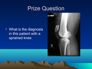 Prize QuestionPrize Question
• What is the diagnosis
in this patient with a
sprained knee
 