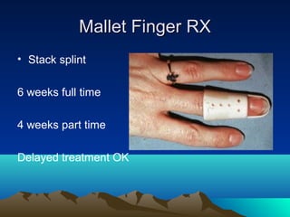 Mallet Finger RXMallet Finger RX
• Stack splint
6 weeks full time
4 weeks part time
Delayed treatment OK
 
