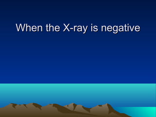 When the X-ray is negativeWhen the X-ray is negative
 