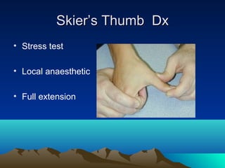 Skier’s Thumb DxSkier’s Thumb Dx
• Stress test
• Local anaesthetic
• Full extension
 