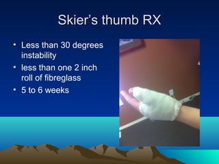 Skier’s thumb RXSkier’s thumb RX
• Less than 30 degrees
instability
• less than one 2 inch
roll of fibreglass
• 5 to 6 weeks
 