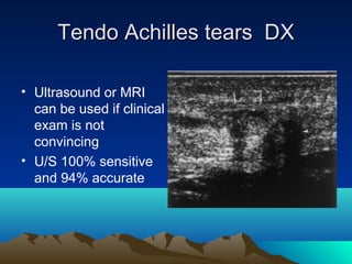 Tendo Achilles tears DXTendo Achilles tears DX
• Ultrasound or MRI
can be used if clinical
exam is not
convincing
• U/S 100% sensitive
and 94% accurate
 
