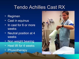 Tendo Achilles Cast RXTendo Achilles Cast RX
• Regimen
• Cast in equinus
• In cast for 6 or more
weeks
• Neutral position at 4
weeks
• Non weight bearing
• Heel lift for 4 weeks
• Physiotherapy
 