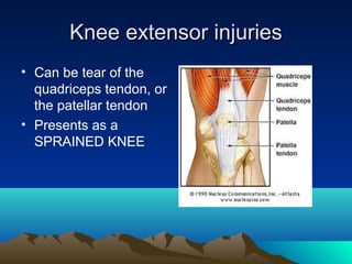 Knee extensor injuriesKnee extensor injuries
• Can be tear of the
quadriceps tendon, or
the patellar tendon
• Presents as a
SPRAINED KNEE
 
