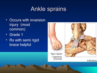 Ankle sprainsAnkle sprains
• Occurs with inversion
injury (most
common)
• Grade 1
• Rx with semi rigid
brace helpful
 