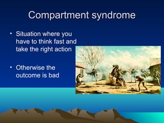 Compartment syndromeCompartment syndrome
• Situation where you
have to think fast and
take the right action
• Otherwise the
outcome is bad
 