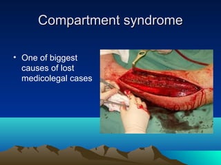 Compartment syndromeCompartment syndrome
• One of biggest
causes of lost
medicolegal cases
 