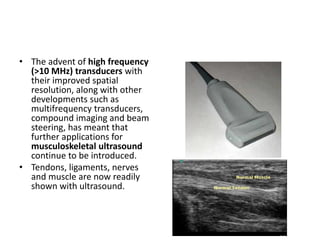 • The advent of high frequency 
(>10 MHz) transducers with 
their improved spatial 
resolution, along with other 
developments such as 
multifrequency transducers, 
compound imaging and beam 
steering, has meant that 
further applications for 
musculoskeletal ultrasound 
continue to be introduced. 
• Tendons, ligaments, nerves 
and muscle are now readily 
shown with ultrasound. 
 