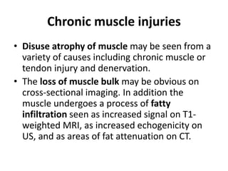 Chronic muscle injuries 
• Disuse atrophy of muscle may be seen from a 
variety of causes including chronic muscle or 
tendon injury and denervation. 
• The loss of muscle bulk may be obvious on 
cross-sectional imaging. In addition the 
muscle undergoes a process of fatty 
infiltration seen as increased signal on T1- 
weighted MRI, as increased echogenicity on 
US, and as areas of fat attenuation on CT. 
 