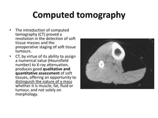 Computed tomography 
• The introduction of computed 
tomography (CT) proved a 
revolution in the detection of soft 
tissue masses and the 
preoperative staging of soft tissue 
tumours. 
• CT, by virtue of its ability to assign 
a numerical value (Hounsfield 
number) to X-ray attenuation, 
produces good qualitative and 
quantitative assessment of soft 
tissues, offering an opportunity to 
distinguish the nature of a mass 
whether it is muscle, fat, fluid or 
tumour, and not solely on 
morphology. 
 