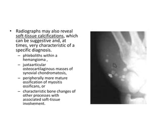 • Radiographs may also reveal 
soft-tissue calcifications, which 
can be suggestive and, at 
times, very characteristic of a 
specific diagnosis. 
– phleboliths within a 
hemangioma , 
– juxtaarticular 
osteocartilaginous masses of 
synovial chondromatosis, 
– peripherally more mature 
ossification of myositis 
ossificans, or 
– characteristic bone changes of 
other processes with 
associated soft-tissue 
involvement. 
 