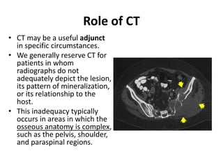 Role of CT 
• CT may be a useful adjunct 
in specific circumstances. 
• We generally reserve CT for 
patients in whom 
radiographs do not 
adequately depict the lesion, 
its pattern of mineralization, 
or its relationship to the 
host. 
• This inadequacy typically 
occurs in areas in which the 
osseous anatomy is complex, 
such as the pelvis, shoulder, 
and paraspinal regions. 
 