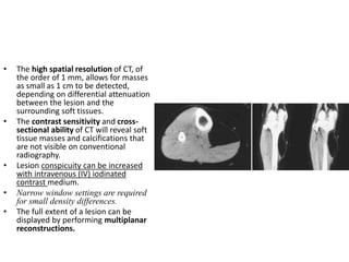 • The high spatial resolution of CT, of 
the order of 1 mm, allows for masses 
as small as 1 cm to be detected, 
depending on differential attenuation 
between the lesion and the 
surrounding soft tissues. 
• The contrast sensitivity and cross-sectional 
ability of CT will reveal soft 
tissue masses and calcifications that 
are not visible on conventional 
radiography. 
• Lesion conspicuity can be increased 
with intravenous (IV) iodinated 
contrast medium. 
• Narrow window settings are required 
for small density differences. 
• The full extent of a lesion can be 
displayed by performing multiplanar 
reconstructions. 
 