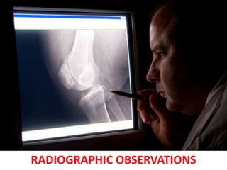RADIOGRAPHIC OBSERVATIONS 
 