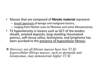 • Masses that are composed of fibrotic material represent 
– broad spectrum of benign and malignant lesions, 
– ranging from fibrotic scars to fibromas and some fibrosarcomas. 
• T2 hypointensity in lesions such as GCT of the tendon 
sheath, amyloid deposits, long-standing rheumatoid 
pannus, soft-tissue callus, leiomyoma, and lymphoma has 
been ascribed to the presence of hypocellular fibrosis. 
 However, not all fibrous masses have low T2 SI; 
hypercellular fibrous masses, such as desmoids and 
leiomyomas, may demonstrate higher T2 SI. 
 