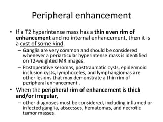 Peripheral enhancement 
• If a T2 hyperintense mass has a thin even rim of 
enhancement and no internal enhancement, then it is 
a cyst of some kind. 
– Ganglia are very common and should be considered 
whenever a periarticular hyperintense mass is identified 
on T2-weighted MR images. 
– Postoperative seromas, posttraumatic cysts, epidermoid 
inclusion cysts, lymphoceles, and lymphangiomas are 
other lesions that may demonstrate a thin rim of 
peripheral enhancement . 
• When the peripheral rim of enhancement is thick 
and/or irregular, 
– other diagnoses must be considered, including inflamed or 
infected ganglia, abscesses, hematomas, and necrotic 
tumor masses. 
 