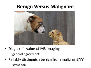 Benign Versus Malignant 
• Diagnostic value of MR imaging 
– general agreement 
• Reliably distinguish benign from malignant??? 
– less clear. 
 