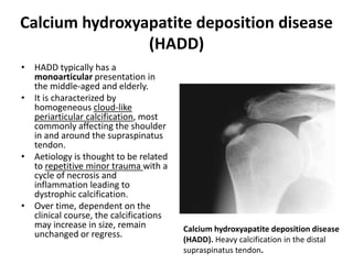 Calcium hydroxyapatite deposition disease 
(HADD) 
• HADD typically has a 
monoarticular presentation in 
the middle-aged and elderly. 
• It is characterized by 
homogeneous cloud-like 
periarticular calcification, most 
commonly affecting the shoulder 
in and around the supraspinatus 
tendon. 
• Aetiology is thought to be related 
to repetitive minor trauma with a 
cycle of necrosis and 
inflammation leading to 
dystrophic calcification. 
• Over time, dependent on the 
clinical course, the calcifications 
may increase in size, remain 
unchanged or regress. 
Calcium hydroxyapatite deposition disease 
(HADD). Heavy calcification in the distal 
supraspinatus tendon. 
 