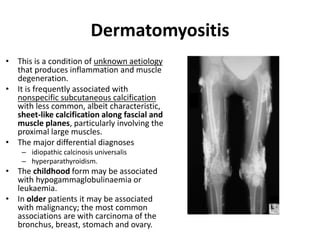 Dermatomyositis 
• This is a condition of unknown aetiology 
that produces inflammation and muscle 
degeneration. 
• It is frequently associated with 
nonspecific subcutaneous calcification 
with less common, albeit characteristic, 
sheet-like calcification along fascial and 
muscle planes, particularly involving the 
proximal large muscles. 
• The major differential diagnoses 
– idiopathic calcinosis universalis 
– hyperparathyroidism. 
• The childhood form may be associated 
with hypogammaglobulinaemia or 
leukaemia. 
• In older patients it may be associated 
with malignancy; the most common 
associations are with carcinoma of the 
bronchus, breast, stomach and ovary. 
 