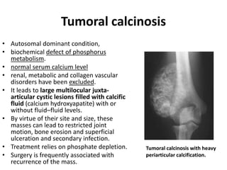 Tumoral calcinosis 
• Autosomal dominant condition, 
• biochemical defect of phosphorus 
metabolism. 
• normal serum calcium level 
• renal, metabolic and collagen vascular 
disorders have been excluded. 
• It leads to large multilocular juxta-articular 
cystic lesions filled with calcific 
fluid (calcium hydroxyapatite) with or 
without fluid–fluid levels. 
• By virtue of their site and size, these 
masses can lead to restricted joint 
motion, bone erosion and superficial 
ulceration and secondary infection. 
• Treatment relies on phosphate depletion. 
• Surgery is frequently associated with 
recurrence of the mass. 
Tumoral calcinosis with heavy 
periarticular calcification. 
 