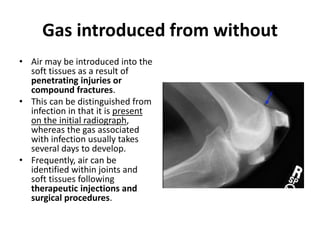 Gas introduced from without 
• Air may be introduced into the 
soft tissues as a result of 
penetrating injuries or 
compound fractures. 
• This can be distinguished from 
infection in that it is present 
on the initial radiograph, 
whereas the gas associated 
with infection usually takes 
several days to develop. 
• Frequently, air can be 
identified within joints and 
soft tissues following 
therapeutic injections and 
surgical procedures. 
 