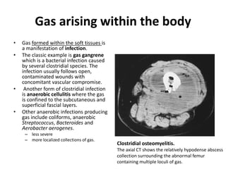 Gas arising within the body 
• Gas formed within the soft tissues is 
a manifestation of infection. 
• The classic example is gas gangrene 
which is a bacterial infection caused 
by several clostridial species. The 
infection usually follows open, 
contaminated wounds with 
concomitant vascular compromise. 
• Another form of clostridial infection 
is anaerobic cellulitis where the gas 
is confined to the subcutaneous and 
superficial fascial layers. 
• Other anaerobic infections producing 
gas include coliforms, anaerobic 
Streptococcus, Bacteroides and 
Aerobacter aerogenes. 
– less severe 
– more localized collections of gas. 
Clostridial osteomyelitis. 
The axial CT shows the relatively hypodense abscess 
collection surrounding the abnormal femur 
containing multiple loculi of gas. 
 