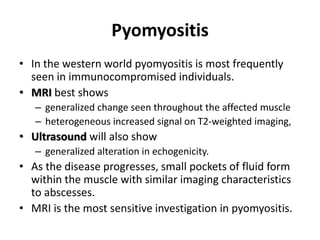 Pyomyositis 
• In the western world pyomyositis is most frequently 
seen in immunocompromised individuals. 
• MRI best shows 
– generalized change seen throughout the affected muscle 
– heterogeneous increased signal on T2-weighted imaging, 
• Ultrasound will also show 
– generalized alteration in echogenicity. 
• As the disease progresses, small pockets of fluid form 
within the muscle with similar imaging characteristics 
to abscesses. 
• MRI is the most sensitive investigation in pyomyositis. 
 