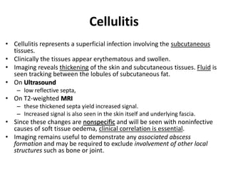 Cellulitis 
• Cellulitis represents a superficial infection involving the subcutaneous 
tissues. 
• Clinically the tissues appear erythematous and swollen. 
• Imaging reveals thickening of the skin and subcutaneous tissues. Fluid is 
seen tracking between the lobules of subcutaneous fat. 
• On Ultrasound 
– low reflective septa, 
• On T2-weighted MRI 
– these thickened septa yield increased signal. 
– Increased signal is also seen in the skin itself and underlying fascia. 
• Since these changes are nonspecific and will be seen with noninfective 
causes of soft tissue oedema, clinical correlation is essential. 
• Imaging remains useful to demonstrate any associated abscess 
formation and may be required to exclude involvement of other local 
structures such as bone or joint. 
 