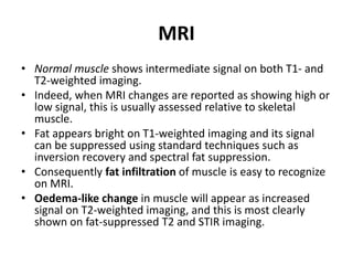 MRI 
• Normal muscle shows intermediate signal on both T1- and 
T2-weighted imaging. 
• Indeed, when MRI changes are reported as showing high or 
low signal, this is usually assessed relative to skeletal 
muscle. 
• Fat appears bright on T1-weighted imaging and its signal 
can be suppressed using standard techniques such as 
inversion recovery and spectral fat suppression. 
• Consequently fat infiltration of muscle is easy to recognize 
on MRI. 
• Oedema-like change in muscle will appear as increased 
signal on T2-weighted imaging, and this is most clearly 
shown on fat-suppressed T2 and STIR imaging. 
 