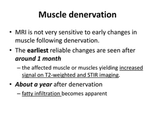 Muscle denervation 
• MRI is not very sensitive to early changes in 
muscle following denervation. 
• The earliest reliable changes are seen after 
around 1 month 
– the affected muscle or muscles yielding increased 
signal on T2-weighted and STIR imaging. 
• About a year after denervation 
– fatty infiltration becomes apparent 
 