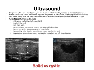 Ultrasound 
• Diagnostic ultrasound has been applied to the musculoskeletal system since B-mode techniques 
became available. There have been rapid developments in ultrasound technology over recent years 
and these, along with the have resulted in a vast expansion in the evaluation of the soft tissues. 
• Advantages of ultrasound include 
– widespread availability of ultrasound and 
– relatively low cost, 
– solid from cystic 
– abnormal tissue from normal variants such as accessory muscles 
– its real-time ability to assess structures dynamically, 
– its capability, using Doppler technology, to assess vascular flow and 
– to guide interventional procedures such as joint aspirations and soft tissue biopsies. 
 